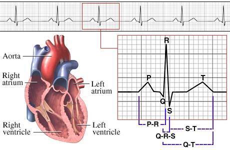 nad ei nõua tingimata ravi peale põhiuuringute EKG (Elektrokardiogramm (vaata joonis 12) on graafiline kujutis, mis tekib südame elektrilise aktiivsuse mõõtmise tulemusena) või laboratoorsed uuringud.