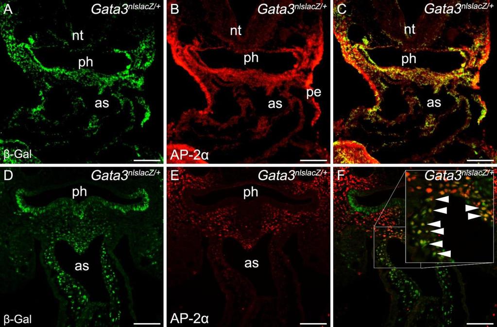 3.2. Gata3 ja AP-2α koekspressioon NH päritolu rakud migreeruvad endokardiaalsetesse padjanditesse mööda 3., 4. ja 6.