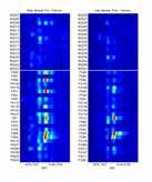 VDX2 array New biomarkers Optimal chemo regimen Low risk High risk Molecular subtype NEOADJUVANT CHEMOTHERAPY