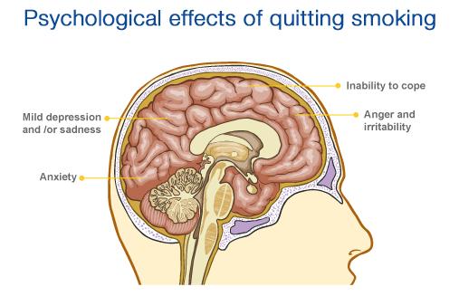 http://www.euroclinix.net/coping-quitsmoking-side-effects.