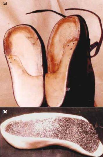 Joonis 3. Thomase kõvera ja pikendatud kannaga jalats (a), Rose Schwartzi sisetald (b) (Pandei et al. 2013). Esimeses grupis leevenes valu 18 patsiendil 60st.