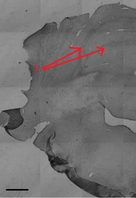 Joonis 11: Keskaju. Joonisel on näha märgistust hipokampuse tagumises osas (1,2) ja mammillary peduncle(3) Joonis 12: Väikeaju.