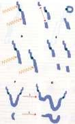 Kromosoomide aberratsioonid Kromosoomide aberratsioonid DELETSIOON osa kromosoomist või kromatiidist kaob tekib atsentriline fragment (ilma tsentromeerita kromosoomi osa) katkenud otste
