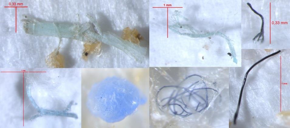 plastosakest/m 3. Põhiliselt leiti siniseid mikroplasti tükke ning musti või halle mikroplasti fiibreid (foto 9). Joonis 10.