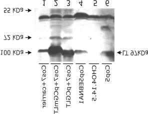 SDSpolüakrüülamiid geelis. EBNA1 valgu ekspressioon on näha nii FREBNA1 plasmiidiga transfekteeritud rakkudes kui ka konstrueeritud Cop5EBNA1 liinis. Joonis 5.