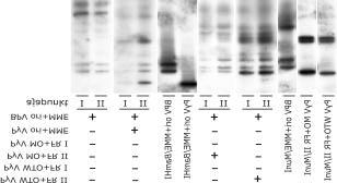 Joonis 13. Erinevatel viiruselistel elementidel põhinevate plasmiidide transientse replikatsiooni analüüs Southern blot meetodil 4P11 rakuliinis.
