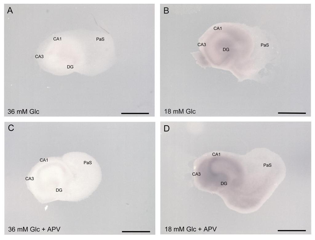 Joonis 3: Grp94 ekspressioon hiire (Mus musculus) hipokampuse lõikudel. In situ hübridisatsioon.