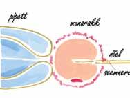 kunstliku viljastamise meetodid Paljude edutult rasestuda proovivate paaride jaoks on olemas mitmesugused keerukamad ravimeetodid, nn abistatud reproduktsiooni meetodid, sealhulgas kehaväline