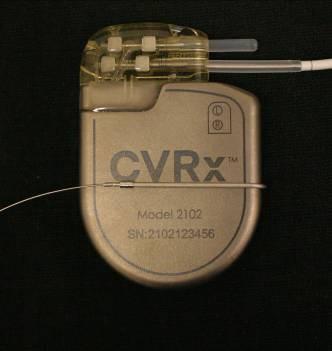 impulsigeneraatorit. Sel juhul ühendage elektroodijuhe otse implanteeritava impulsigeneraatori päisesse ja pingutage fikseerimiskruvisid momendimõõtevõtmega.