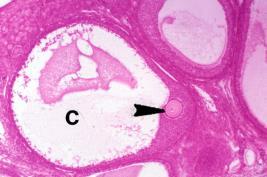 (Graaf s) Ovary - cortex with