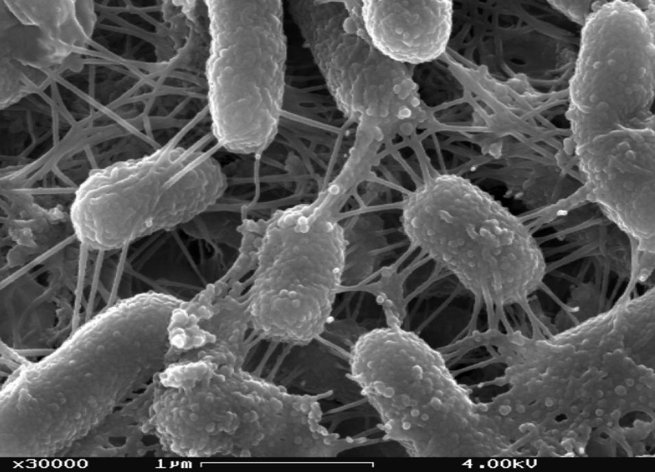 Joonis 5. SEM mikrograaf baktereid ühendavatest nanojuhtmetest (http://bluetechblog.com/2010/06/15/make-electricity-not-sludge/) S.