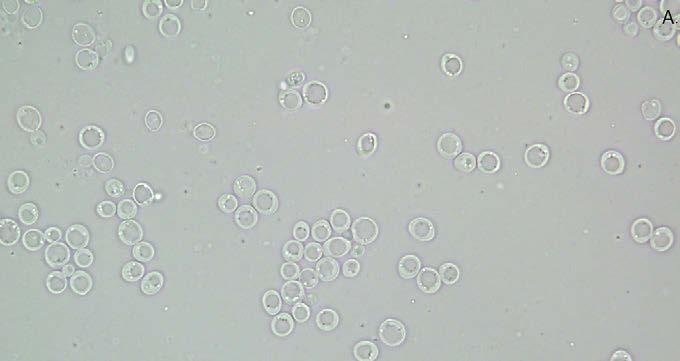 5. Pagaripärm Saccharomyces cerevisiae. A fotografeeritud tavalise valgusmikroskoobiga, suurendus 100 x. B DIC-mikroskoobis nähtav preparaat, suurendus 100 x, okulaar 10 x.