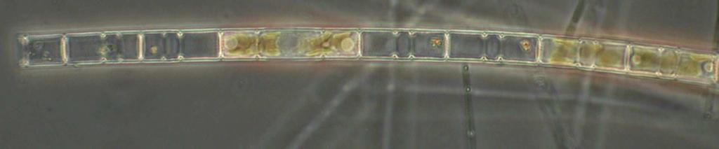 13.7. RÄNIVETIKAD 105 Joonis 13.37: Aulacoseira ambigua ketasränivetikas, mis moodustab niitjaid kolooniaid. Emajõest. Iga rakk on kui väike tünnike, millest niit moodustub.