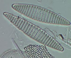45: Olulised planktilised ränivetikate perekonnad magevetes: Melosira (ülemine, ketasränivetikas, üksikud rakud on niitjas koloonias) ja Tabellaria (alumine, sulgränivetikas, moodustab