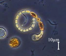 52 PEATÜKK 9. SINIVETIKAD E. TSÜANOBAKTERID rakkudest. Intensiivne akineetide moodustamine on iseloomulik vananevatele populatsioonidele, nagu näiteks veeõitsengu lõppfaas.