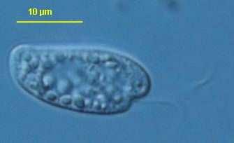 Magevees ja meres elav perekond Gonyomonas seevastu on fagotroofne. Nukleomorf.