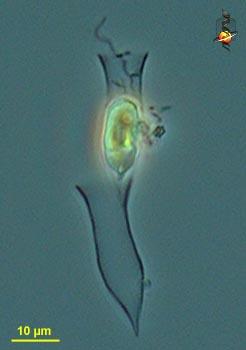 8: Dinobryon spp. üksikud rakud loorikas. Hästi on näha viburid.